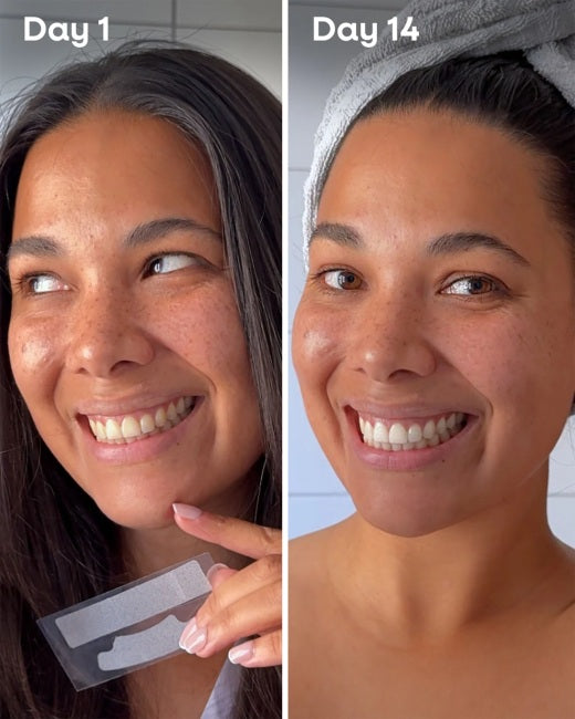 Tiras Dentales Blanqueadoras Aloe Vera The Humble Co.