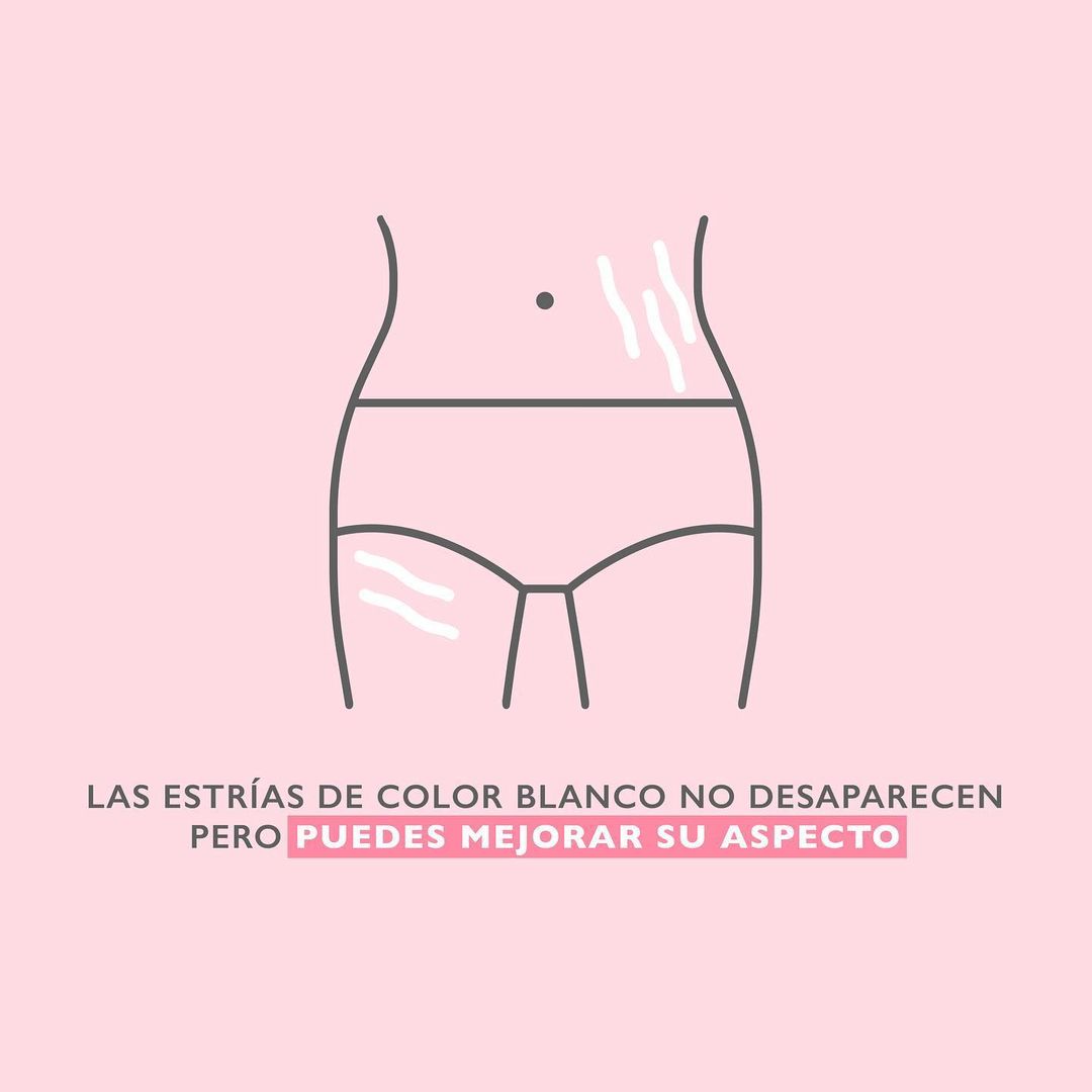 Esential Aroms Aceite Corporal Estrías 100 ml